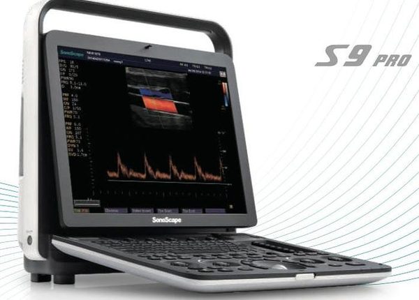 SonoScape S9 Pro Ultrasound System